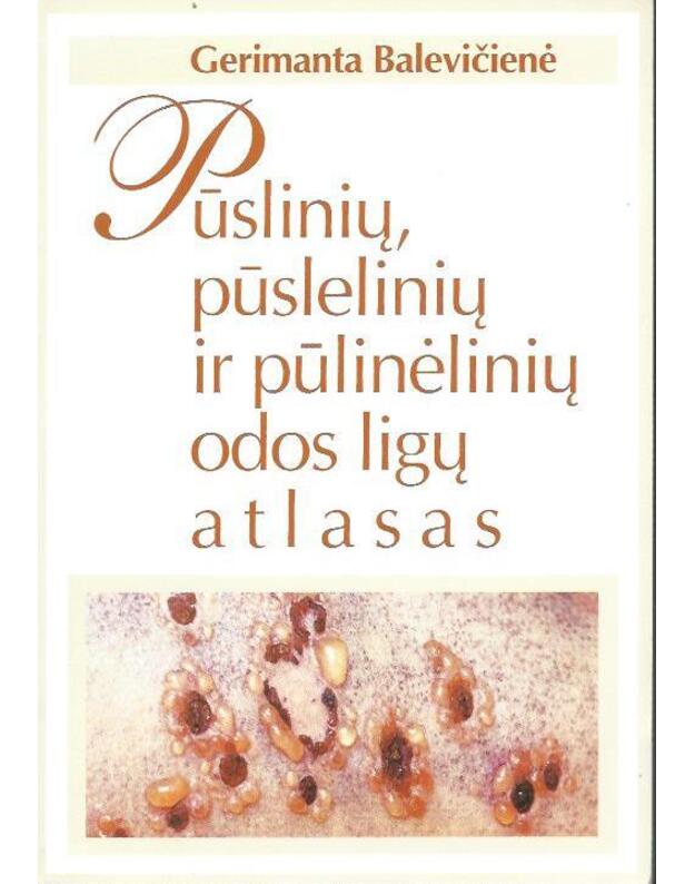 Pūslinių, pūslelinių ir pūslinėlinių odos ligų atlasas - Balevičienė Gerimanta